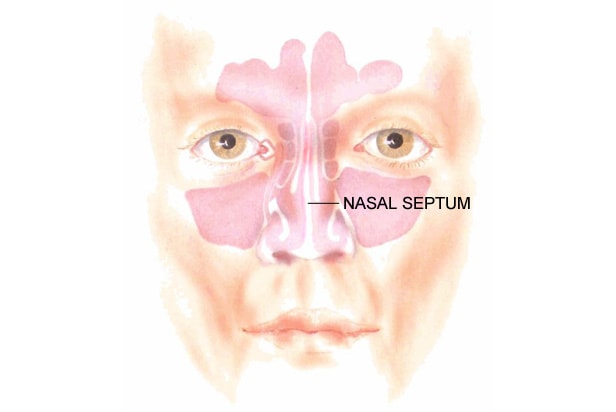 Why Can't I Breathe Well Through My Nose? (Nasal Obstruction and